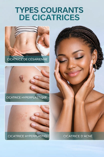 SOUTH MOON Spray Réducteur de Cicatrices – Peau Lisse & Régénérée