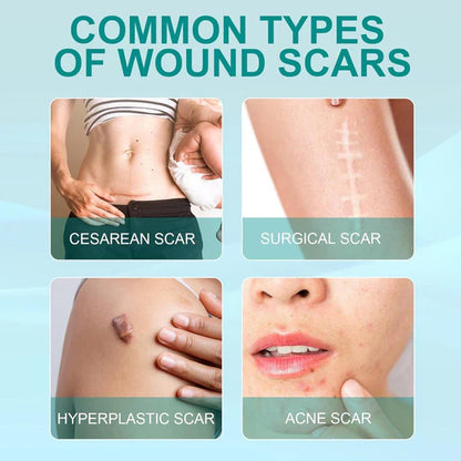 SOUTH MOON Spray Réducteur de Cicatrices – Peau Lisse & Régénérée