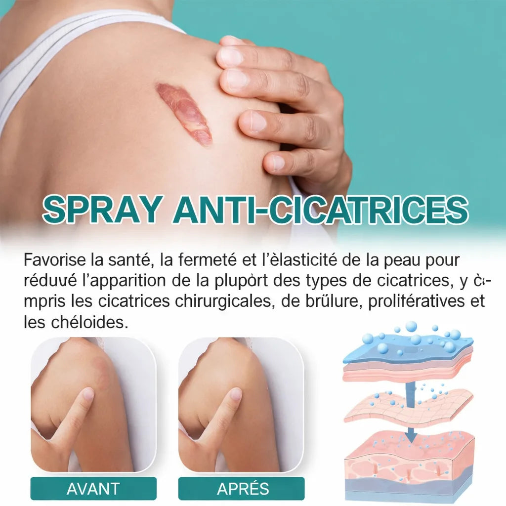 SOUTH MOON Spray Réducteur de Cicatrices – Peau Lisse & Régénérée